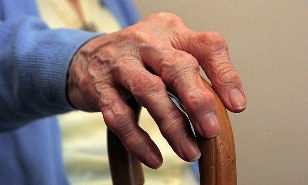 liječenje i znakove artritisa i artroze zglobova