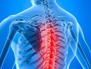 bol u donjem dijelu leđa u zglobovima prsa bol u zglobovima i sacrum