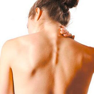 cervikalna osteohondroza liječenje boli u ramenu dijeta za jake bolove u zglobovima