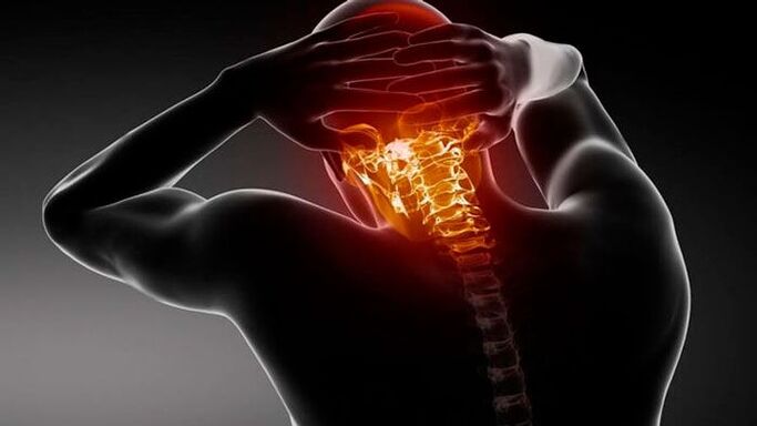 glavobolje sa cervikalnom osteohondrozo