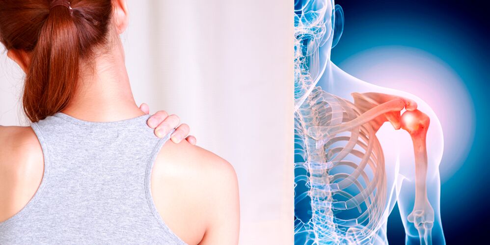 Razvoj osteoartritisa ramena postepeno dovodi do stalne boli