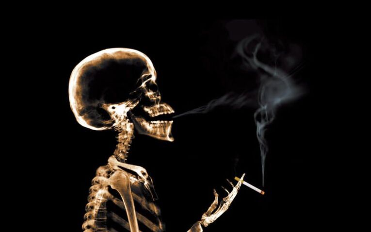 pušenje kao uzrok bolova u leđima u predjelu lopatica