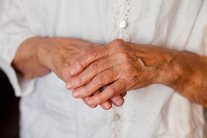 Bolovi u zglobovima šaka često muče starije osobe